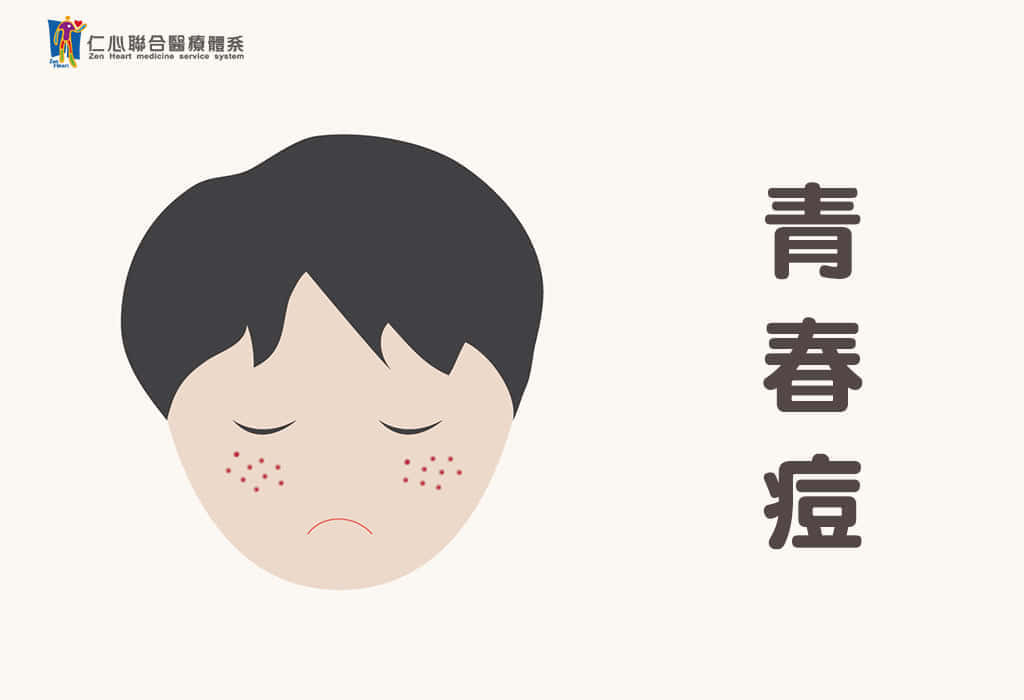 青春痘(脸部座疮)、月经不调